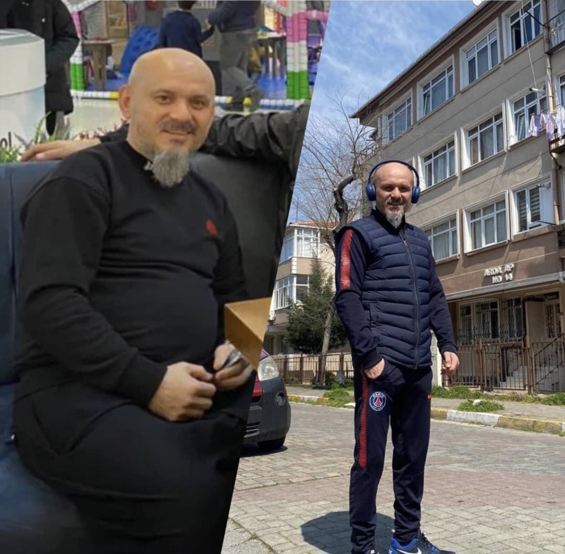 Hastaların ameliyat öncesi sonrası